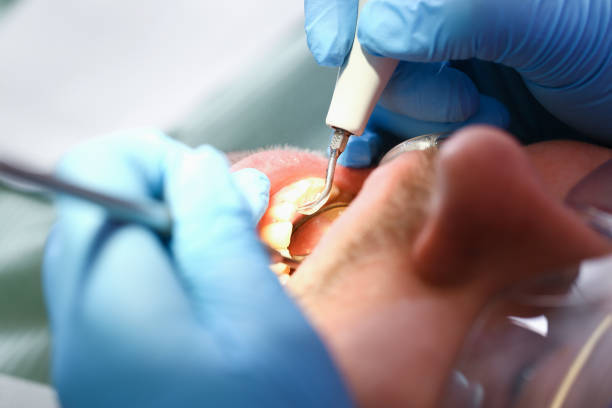 Best Broken Tooth Emergency  in Lindenhurst, IL