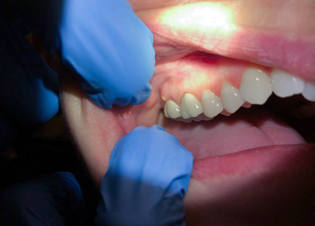 Best Root Canal Emergency Dentist  in Lindenhurst, IL