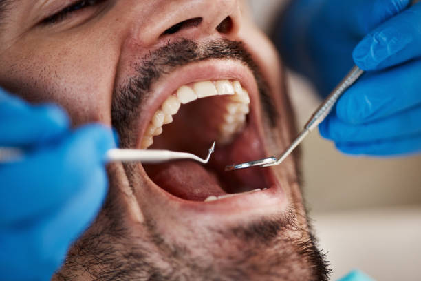Best Dentist for Tooth Abscess  in Lindenhurst, IL